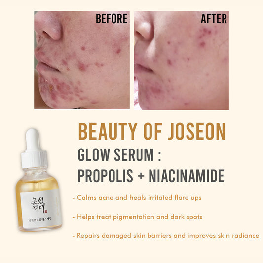 Beauty of Joseon Propolis + Niacinamide Glow Serum 30ml