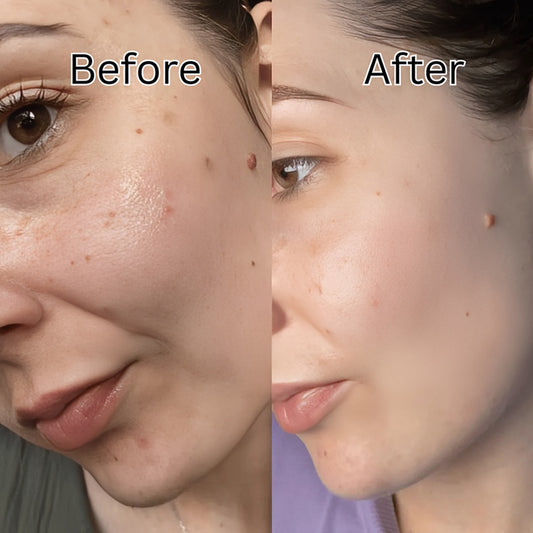 Anua Niacinamide 10% TXA 4% Dark Spot Removing Serum 30ml